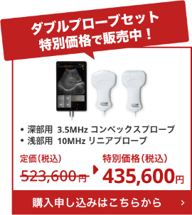 ダブルプローブセット特別価格で販売中！定価523,600円から特別価格435,600円。購入申し込みはこちらから。