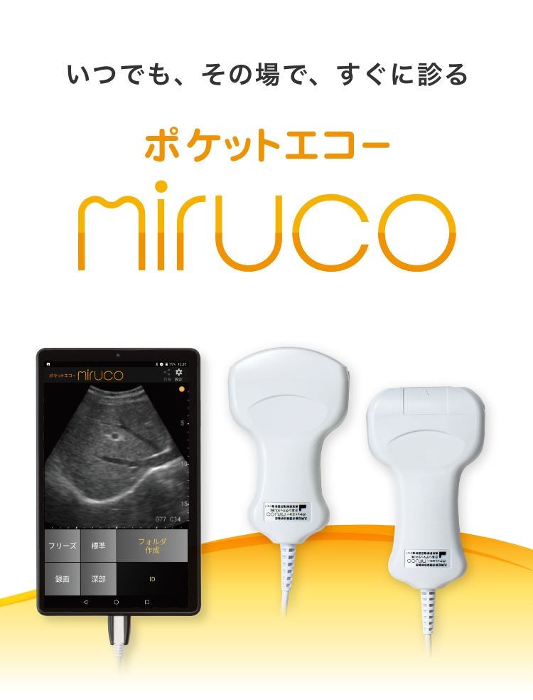 超音波診断装置ポケットエコー miruco （ミルコ）｜軽量、簡単な操作性